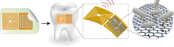 Biotransferrable Graphene Wireless Biosensor