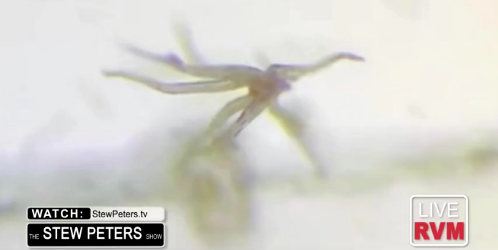 An object with tentacles that was moving and able to lift itself up off the glass slide
