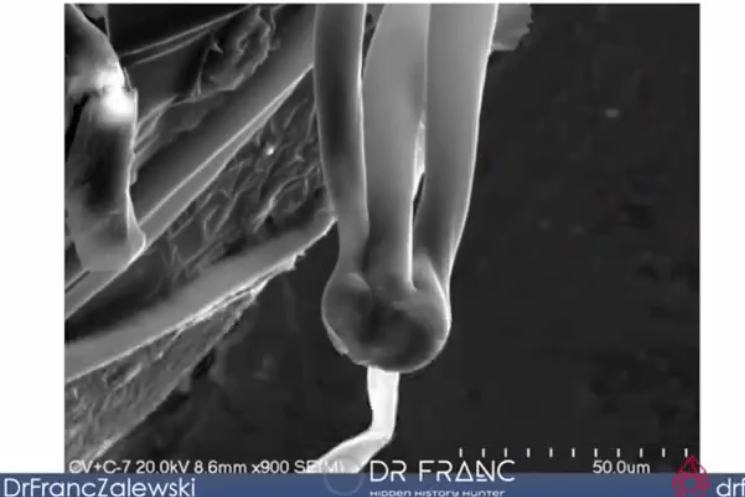 An aluminum-based life-form hatches from "eggs" found in some vaxx vials says Dr. Franc Zalewski