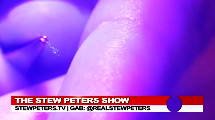 Sharp thread-like organism pulled from body of vaxxed soldier